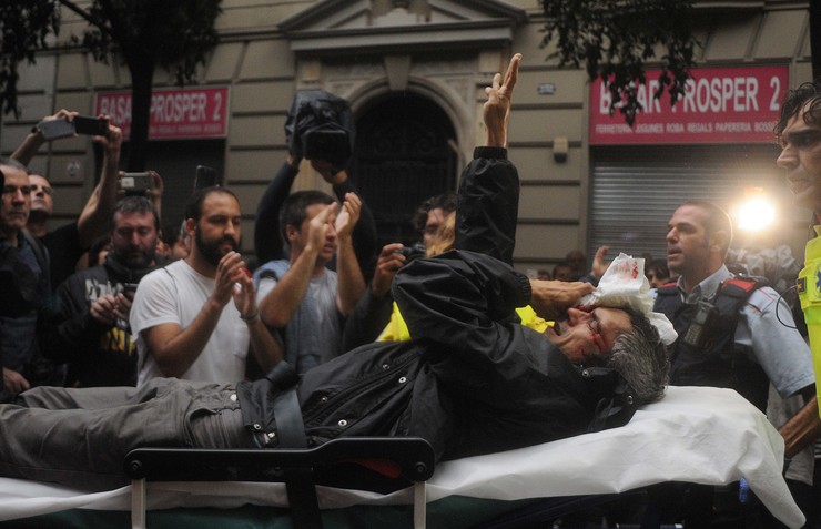 Incidentes entre antidisturbios e manifestantes durante o referendo de independencia de Cataluña/ Miguel Núñez Ferido por pelotas de goma / Miguel Núñez