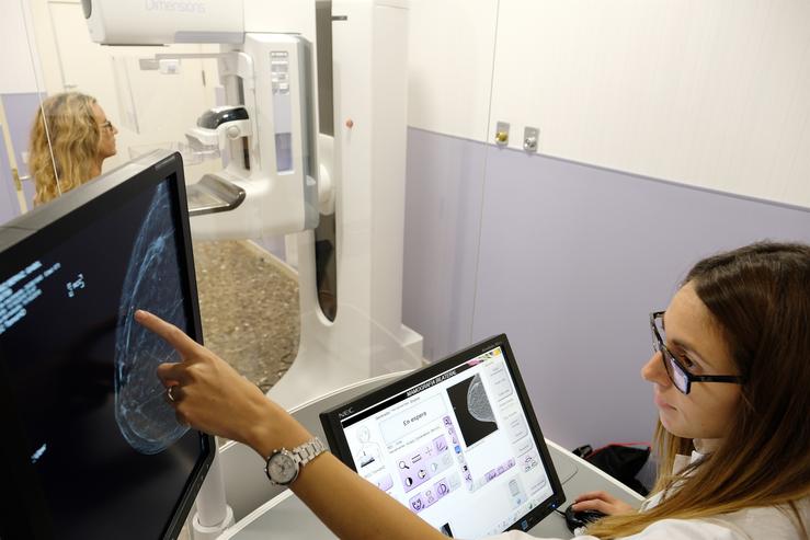 Un novo método de intelixencia artificial predí o risco futuro de cancro de mama. HM DELFOS - Arquivo / Europa Press