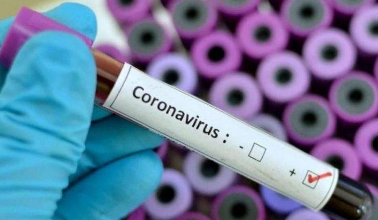 Coronavirus 