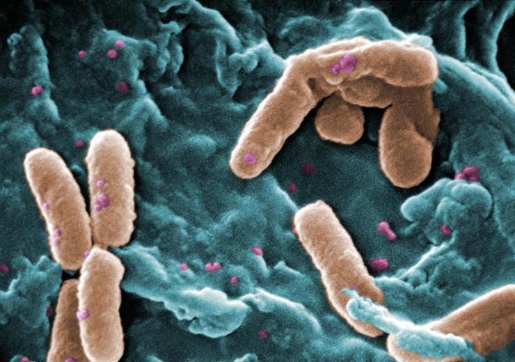 Imaxe da bacteria Pseudomona aeruginosa 