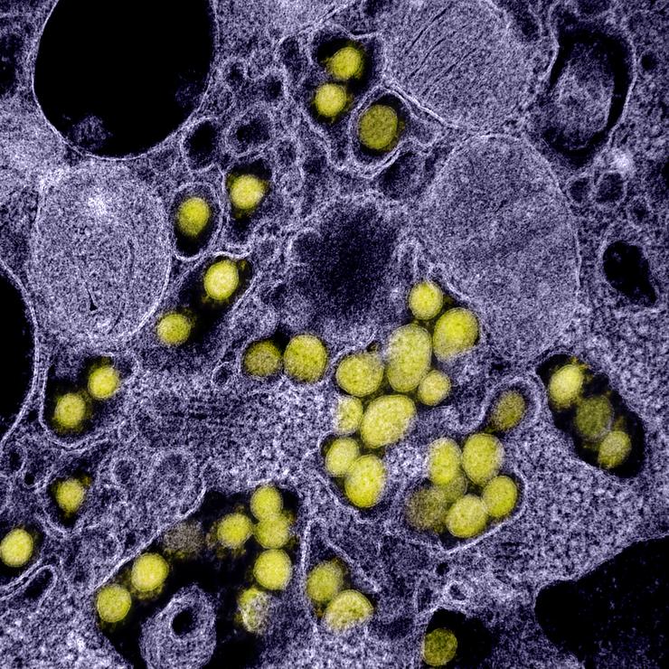 Micrografía electrónica de transmisión de partículas do virus SARS-CoV-2, illada dun paciente e con realce da cor, do Instituto estadounidense de Alerxia e Enfermidades Infecciosas (NIAID), en Hamilton 