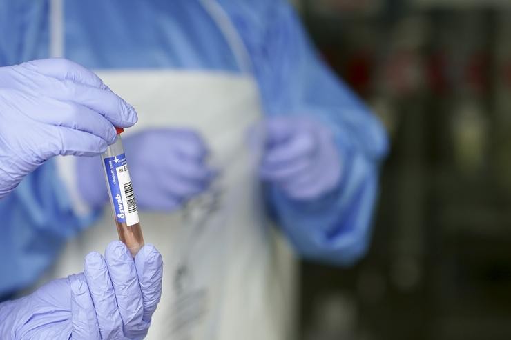 Un sanitario protexido con luvas sostén unha mostra para realizar unha Análise PCR nun local de Deputación de Bizkaia, onde recollen mostras de traballadores funcionarios que deron positivo en Covid-19 ou estiveron en risco de dalo, en Bilbao