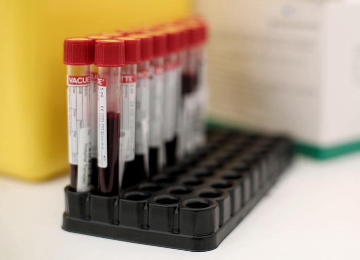 Mostras de sangue para busca de coronavirus.. Eduardo Parra - Europa Press - Arquivo