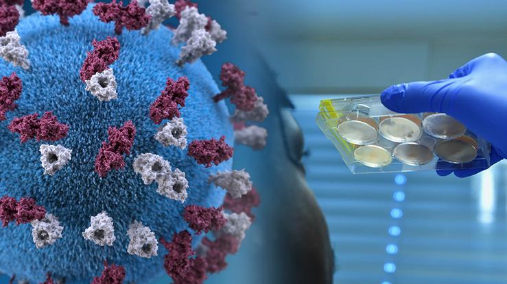 Detección do coronavirus SARS-CoV-2, causante da covid-19, mediante PCR en tempo real (RT-PCR) 