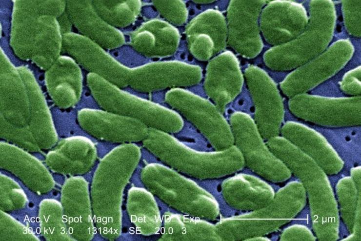 Bacterias da familia Vibrio vulnificus vistas por microscopio / Janice Haney Carr - CDC (coloreado por James Gathany)