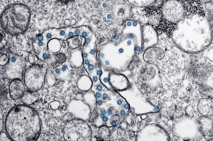 Partículas do virus SARS-CoV-2, coloreadas en azul, nunha imaxe de microscopio de electróns. 