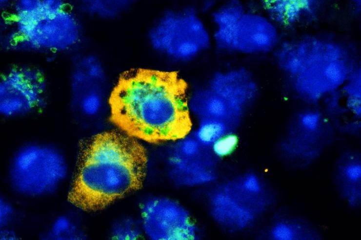 Células do SARS-CoV-2 (amarelo) infecta as células de ril de mono 