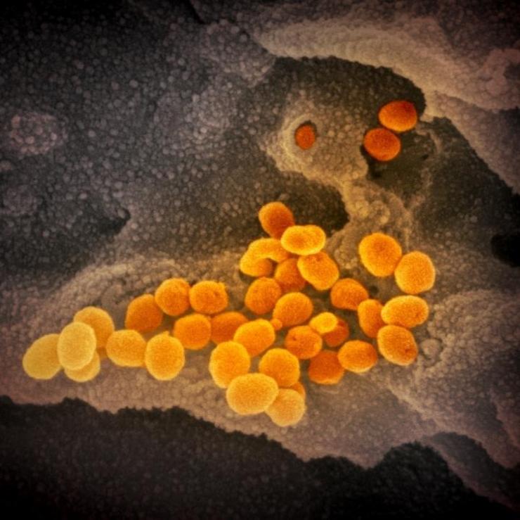 Esta imaxe de microscopio electrónico de varrido mostra o SARS-CoV-2 (laranxa), o virus que causa a COVID-19, illado dun paciente en EE.UU. O virus emerxe da superficie das células (gris) cultivadas no laboratorio 
