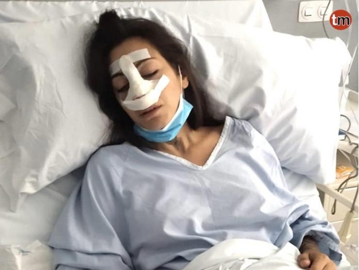 A vítima da presunta agresión acontecida en Vigo tras tentar deter un caso de maltrato animal/Noa Alonso