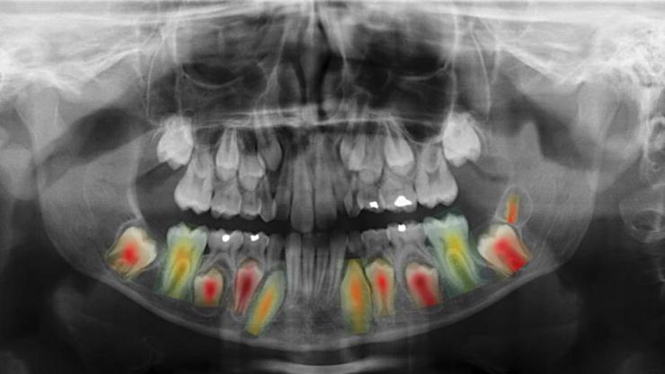 Unha das rexións anatómicas máis relevantes usadas neste proceso é a cavidade oral, xa que contén certas estruturas moi útiles, como os dentes e a mandíbula 