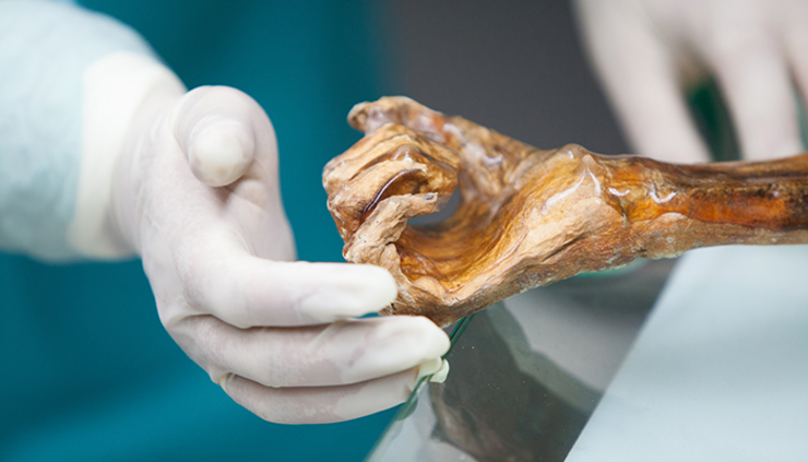 Investigadores da USC rastrexan a traxectoria xenética de Ötzi, unha das momias máis antigas de Europa 