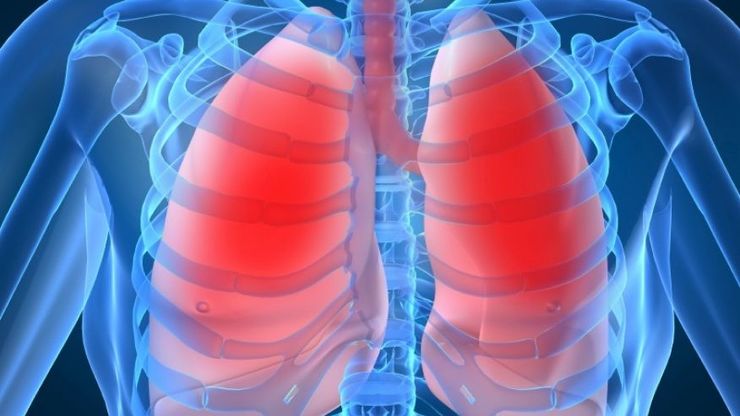 As enfermidades pulmonares sitúanse entre as doenzas que máis mortes causan.