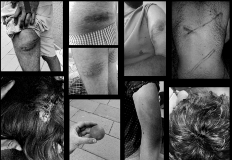 Fotomontaxe das lesións durante os incidentes da manifestación do día do desaloxo do CSO Escarnio e Maldizer, incluído nunha publicación dos okupas