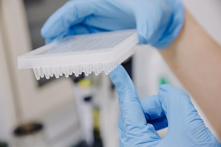 Un técnico de laboratorio prepara unha PCR para a análise de varíola do mono / Carlos Luján - Europa Press.