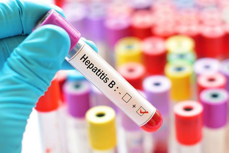 Test de hepatite B 