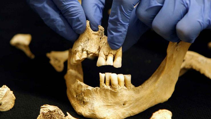 Dentes para o seu estudo arqueolóxico / Commons