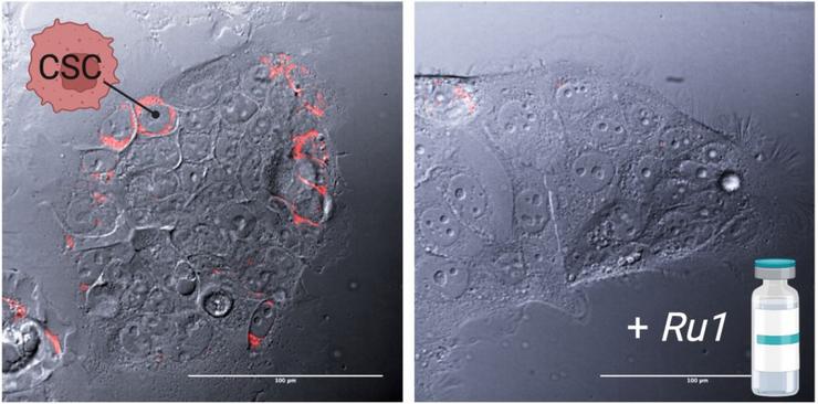 Investigadores da USC e o CSIC desenvolven un novo composto que actúa sobre as células nai canceríxenas / USC