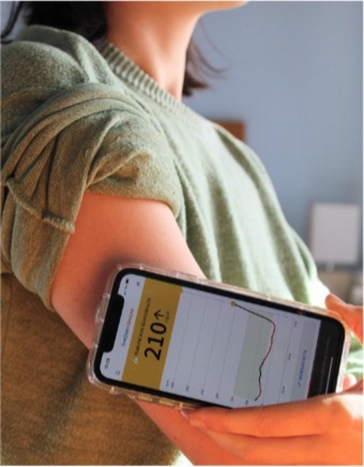 Sensor diabetes /Cedida por Elena Moure